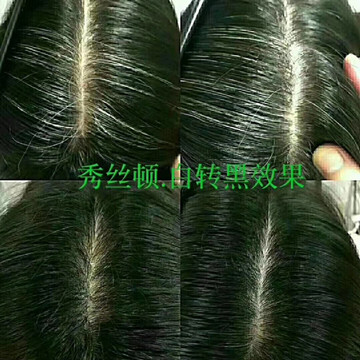 秀丝顿养发解决一切脱发白发问题