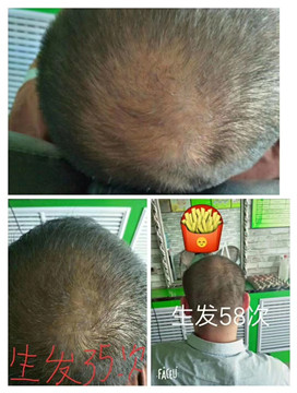 生发一定要明白它的原理