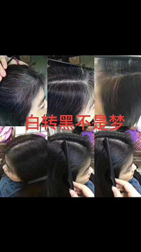白发变黑发的好处我就不说了
