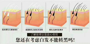 白发不是一次性的转黑的