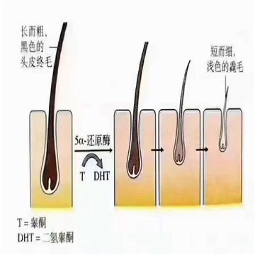 头发的颜色主要取决于？