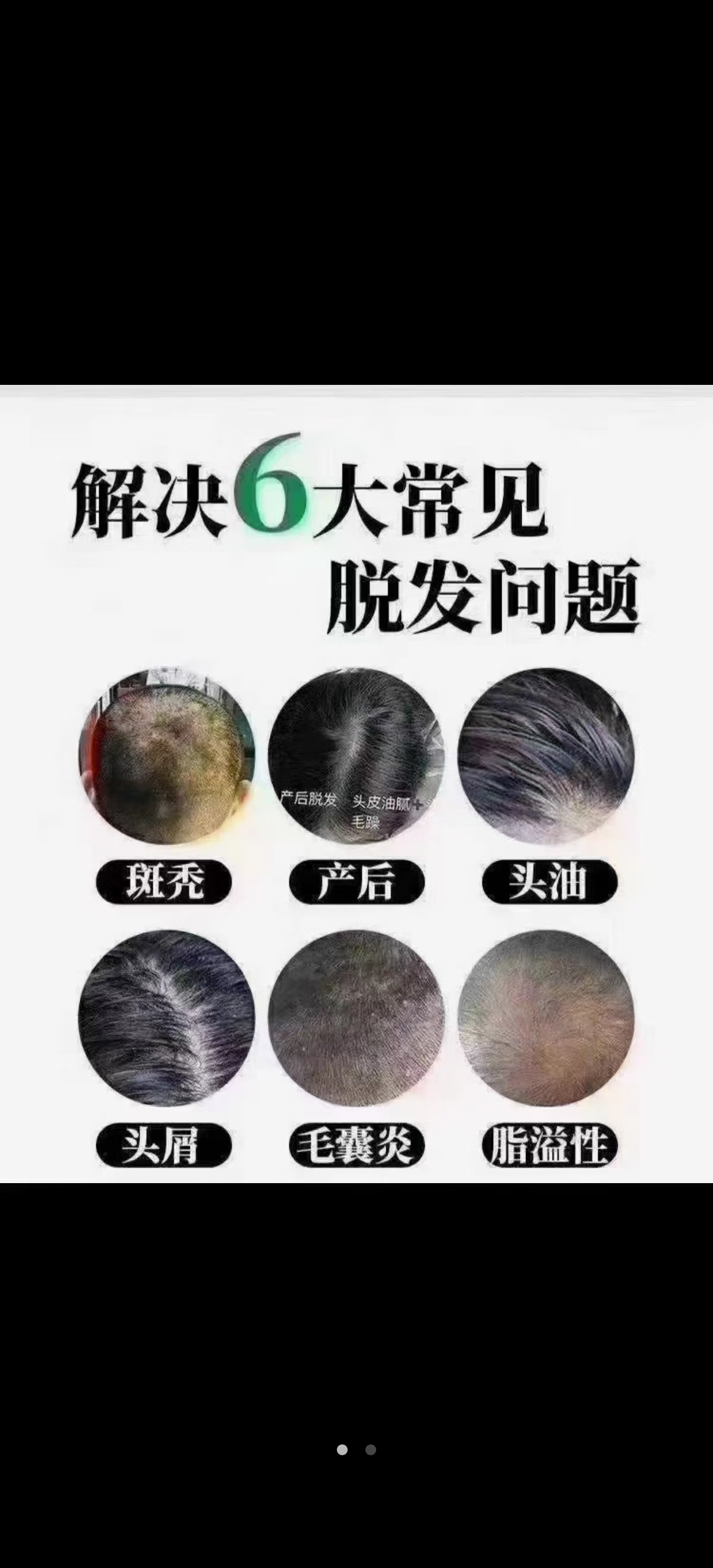 防脱生发
