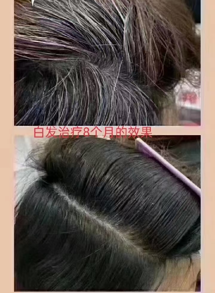 什么是白发转黑