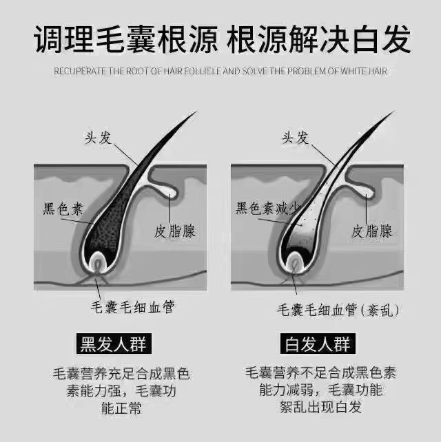 白发不是突然长出来的