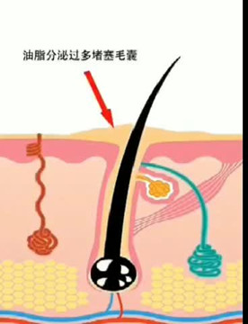 浓缩天然植物，以精见强——就在秀丝顿植物养发馆