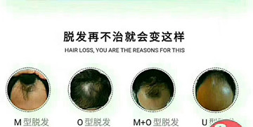 秀丝顿植物养发馆 引领头皮护理新时尚