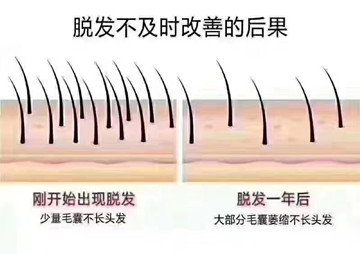 细弱(受损)发质 怎么护理？