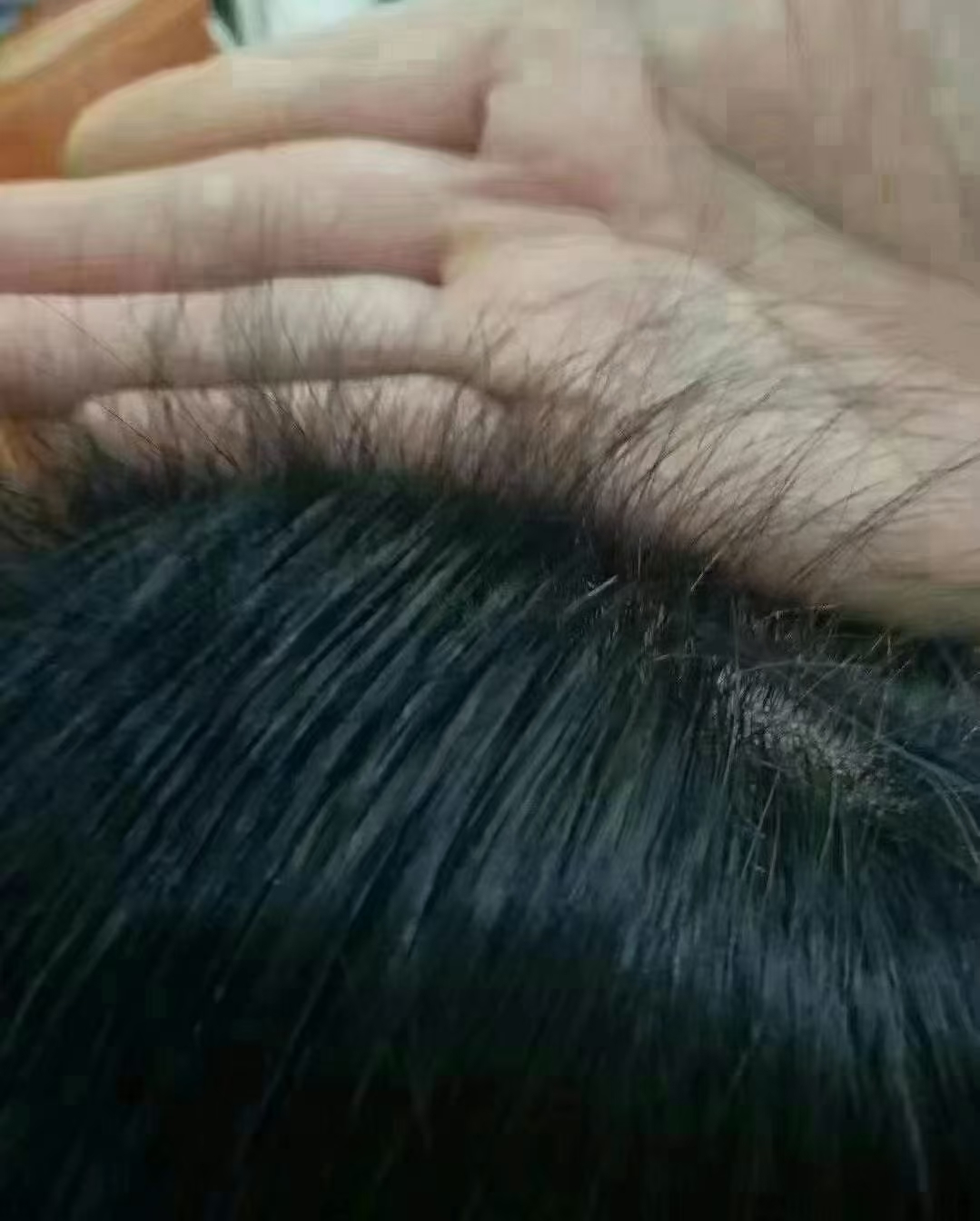 白发养黑后不用担心一年比一年白发量增多