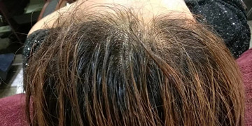 秀丝顿、 植物养发