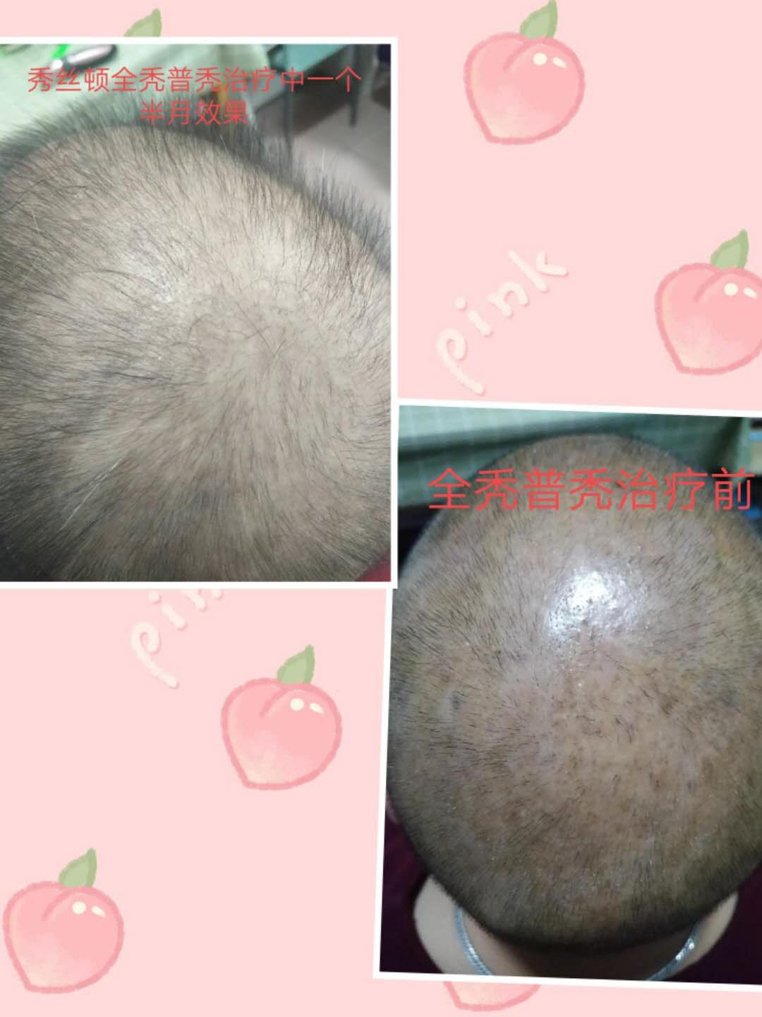 生发原理