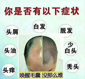 ‮发脱‬遇到‮延拖‬症，只会导致4个结果