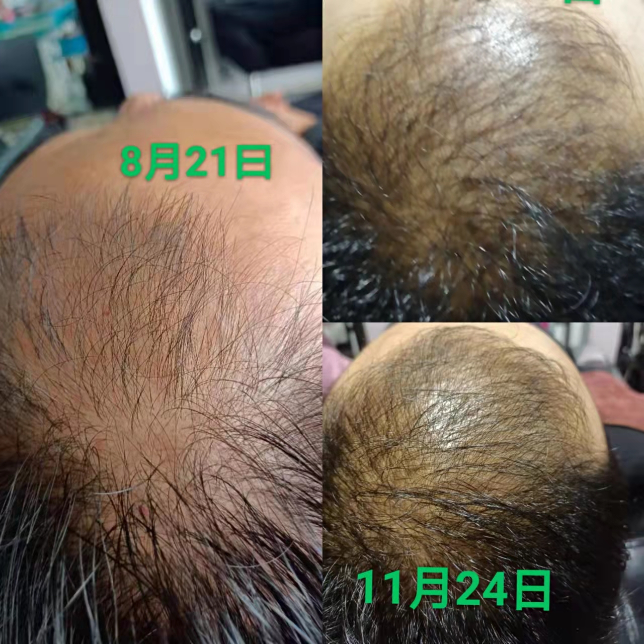 KPT自然免疫疗法部分展示效果