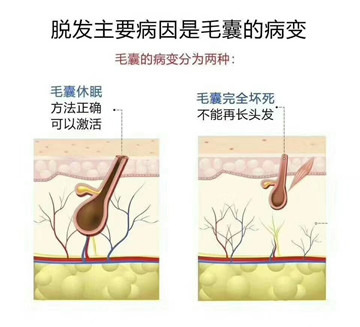 你不得不知的加盟海娜粉养发馆5大支持