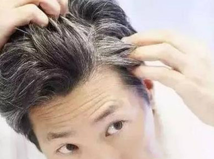 纯植物养发为你们准备的头发防白的方法
