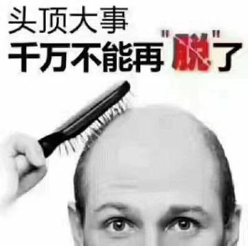 常见的脱发类型