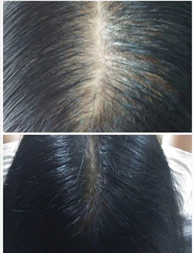 秀丝顿植物养发加盟之植物染发一般可以维持多久