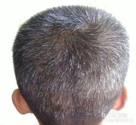 秀丝顿植物养发馆加盟之你真的脱发了吗?