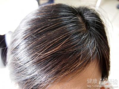 秀丝顿植物养发馆加盟之白发