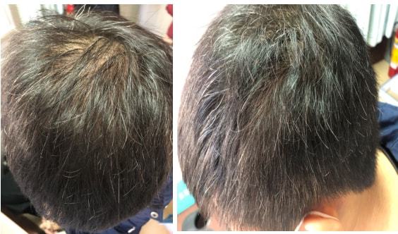 秀丝顿植物养发馆加盟之海娜粉的作用