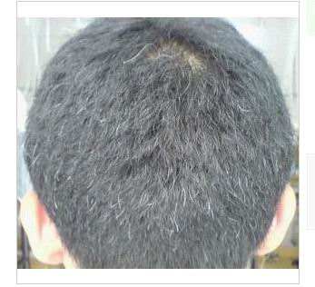 秀丝顿植物养发馆加盟之头发的颜色是什么决定的