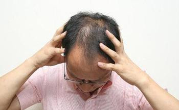 秀丝顿植物养发馆加盟之头发太油怎么办？