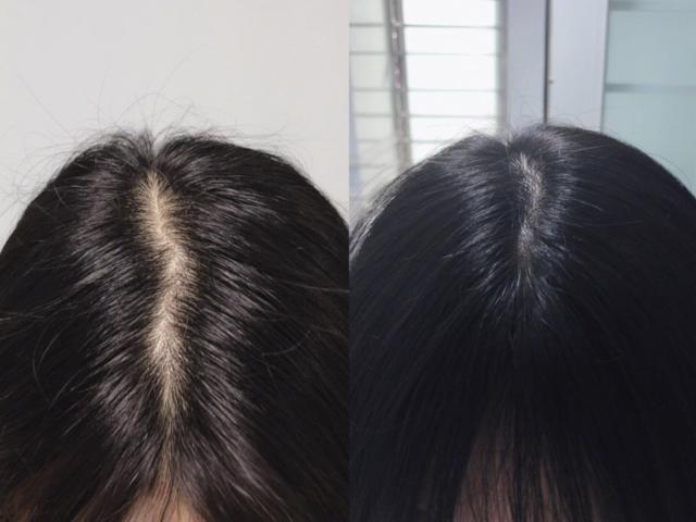 秀丝顿植物养发馆加盟之为什么色素细胞会衰退和减少