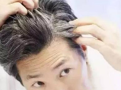 秀丝顿植物养发馆加盟之如何来预防白发呢