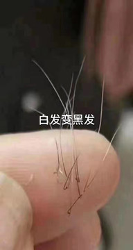 秀丝顿植物养发馆加盟之头发再生的方法有哪些